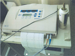 Mejora de Salud materno-neonatal